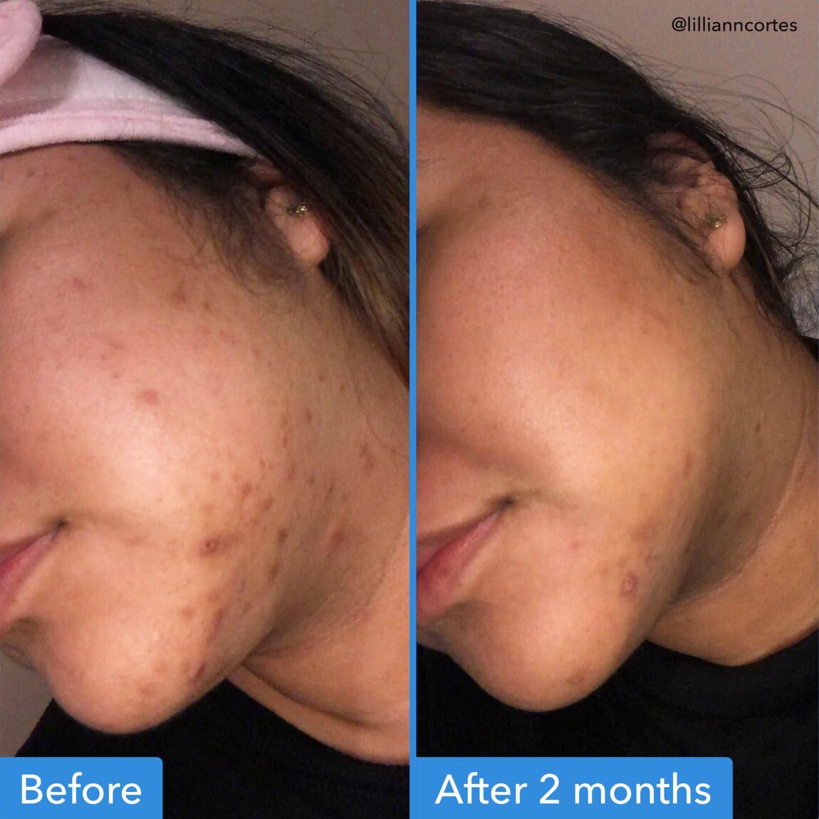 discoloration-correcting-serum-e7 zb_p.jpg
