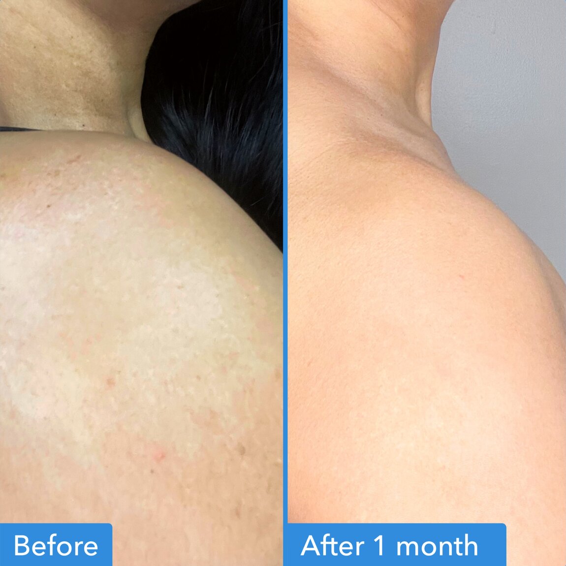 discoloration-correcting-body-treatment-p1 zb_p.jpg