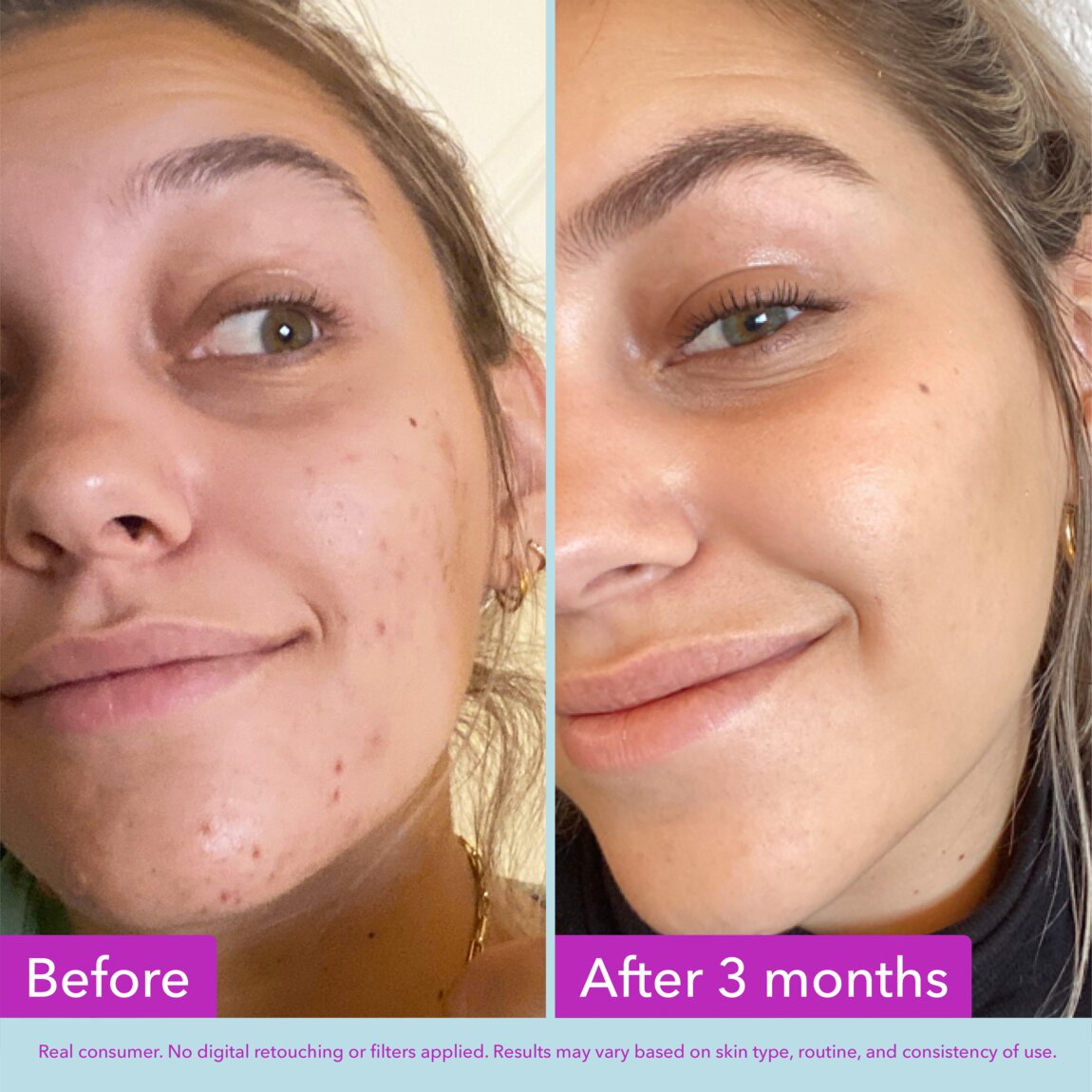 niacinamide-brightening-toner-r8 zb_p.jpg